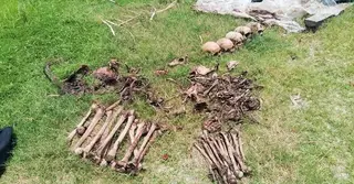 জামালপুরে ময়লার স্তূপ থেকে মানুষের মাথার খুলি ও হাড় উদ্ধার